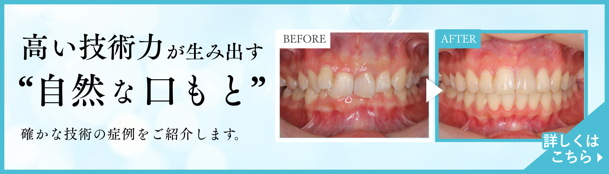 確かな技術の症例をご紹介します